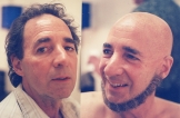 bald0003